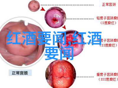 黑龙江小麦主产区在哪来听我细说